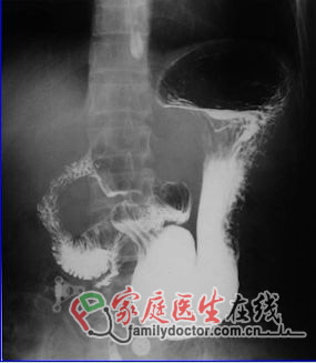 CT檢查、X線檢查等常用醫(yī)學(xué)影像學(xué)檢查方法的價值和局限