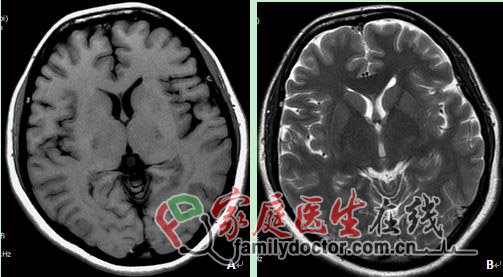 CT檢查、X線檢查等常用醫(yī)學(xué)影像學(xué)檢查方法的價(jià)值和局限